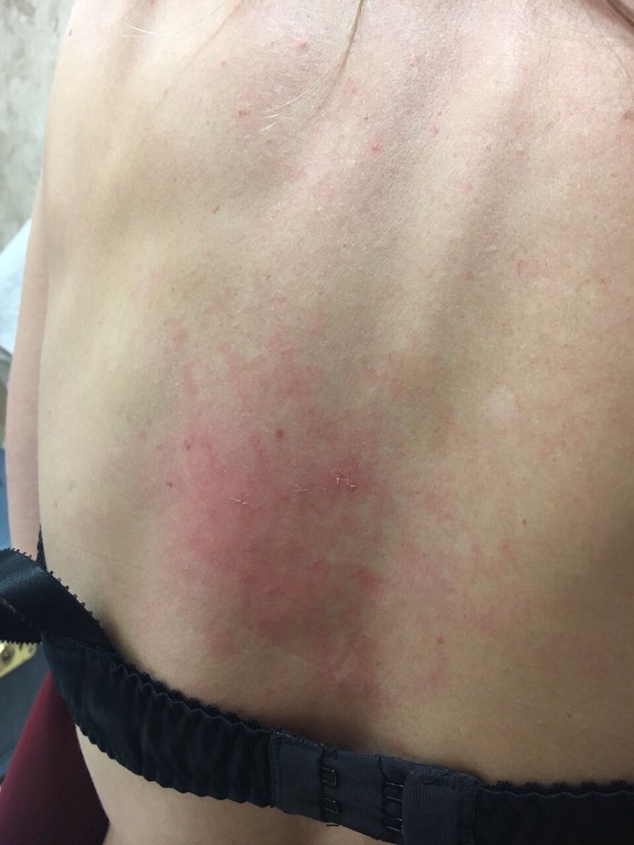 Ольгу Фреймут ударил директор мясокомбината